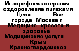 Иглорефлексотерапия, оздоровление пиявками › Цена ­ 3 000 - Все города, Москва г. Медицина, красота и здоровье » Медицинские услуги   . Крым,Красногвардейское